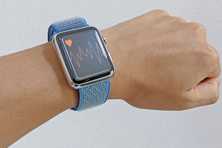 Apple Watch外来のイメージ画像
