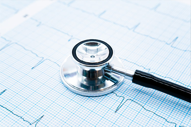 不整脈のイメージ画像