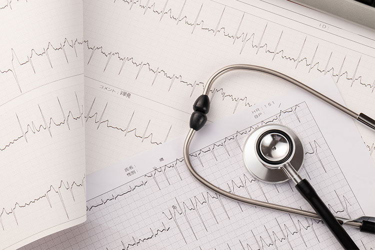 循環器内科のイメージ画像